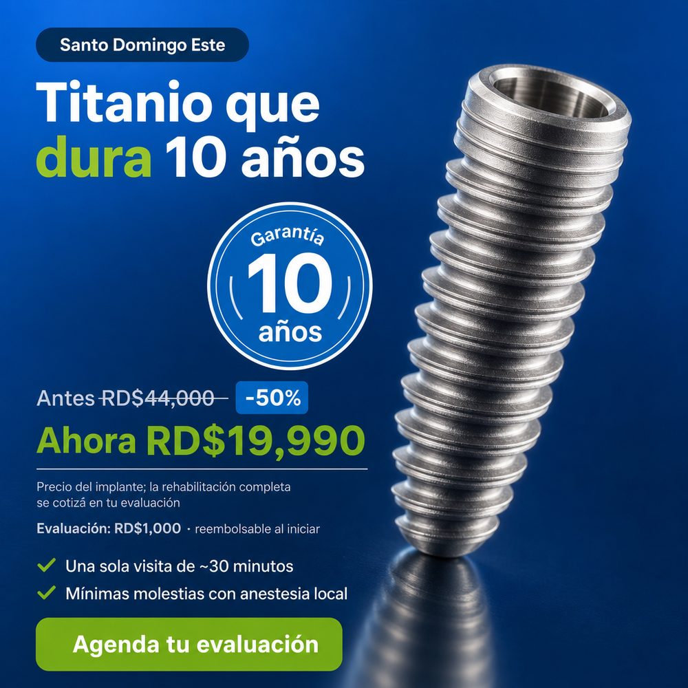 Implantes dentales: durabilidad/calidad (garantia)