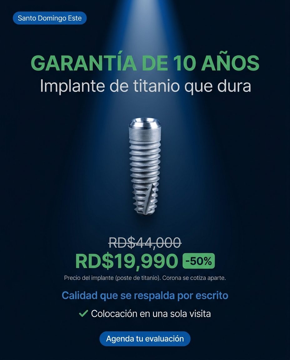 Implantes dentales: durabilidad/calidad (garantia)
