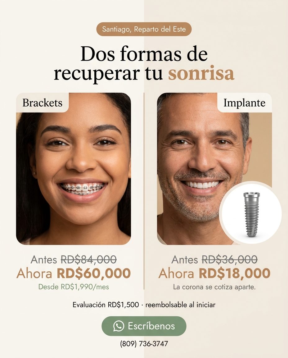 Brackets + Implantes (dual): Precio dual: Brackets 60k + Implante 18k