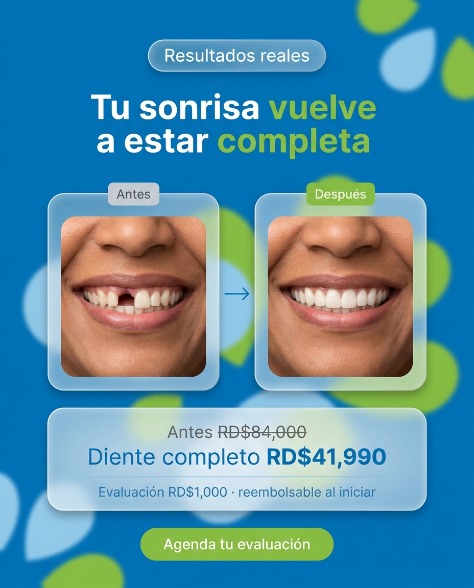 Implantes: Antes / Después: recupera el espacio vacío